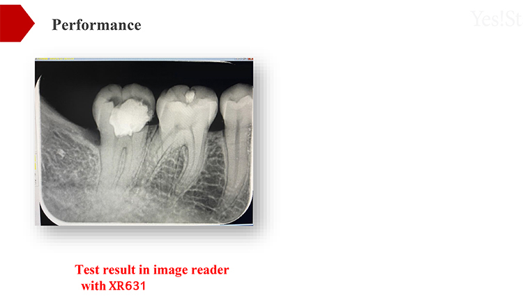 XR631 Phosphor Plates with passpord1